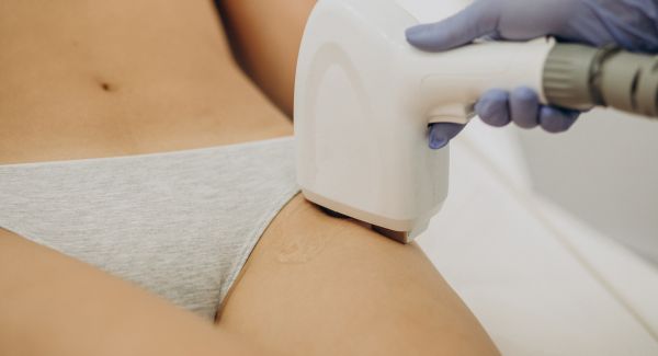 DEPILACIÓN LASER DEFINITIVA