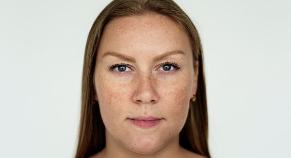 ✨TRATAMIENTO FACIAL DESPIGMENTANTE AVANZADO 🤍💎